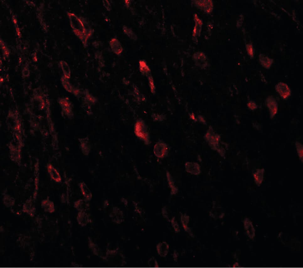 IHC-plus™ TSHZ3 Antibody