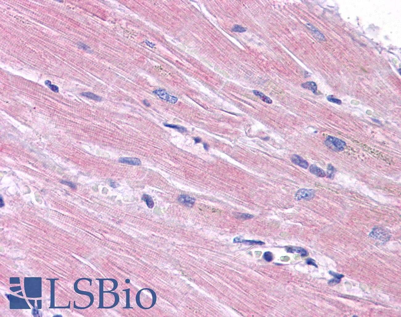 IHC-plus™ PPAPDC3 Antibody