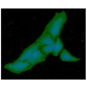 IHC-plus™ PGM1 / Phosphoglucomutase 1 Antibody (clone AT84G2)