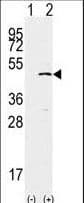 SETD7 / SET7 Antibody (aa159-189)