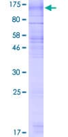 Human RNF139 / TRC8 Protein (Recombinant GST)