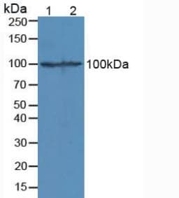 CTNNB1 / Beta Catenin Antibody (aa508-762)