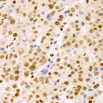 Polyclonal Rabbit anti-Human DKC1 / Dyskerin Antibody (IHC, IF, WB)