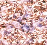 RB1 / Retinoblastoma / RB Antibody (phospho-Ser788)