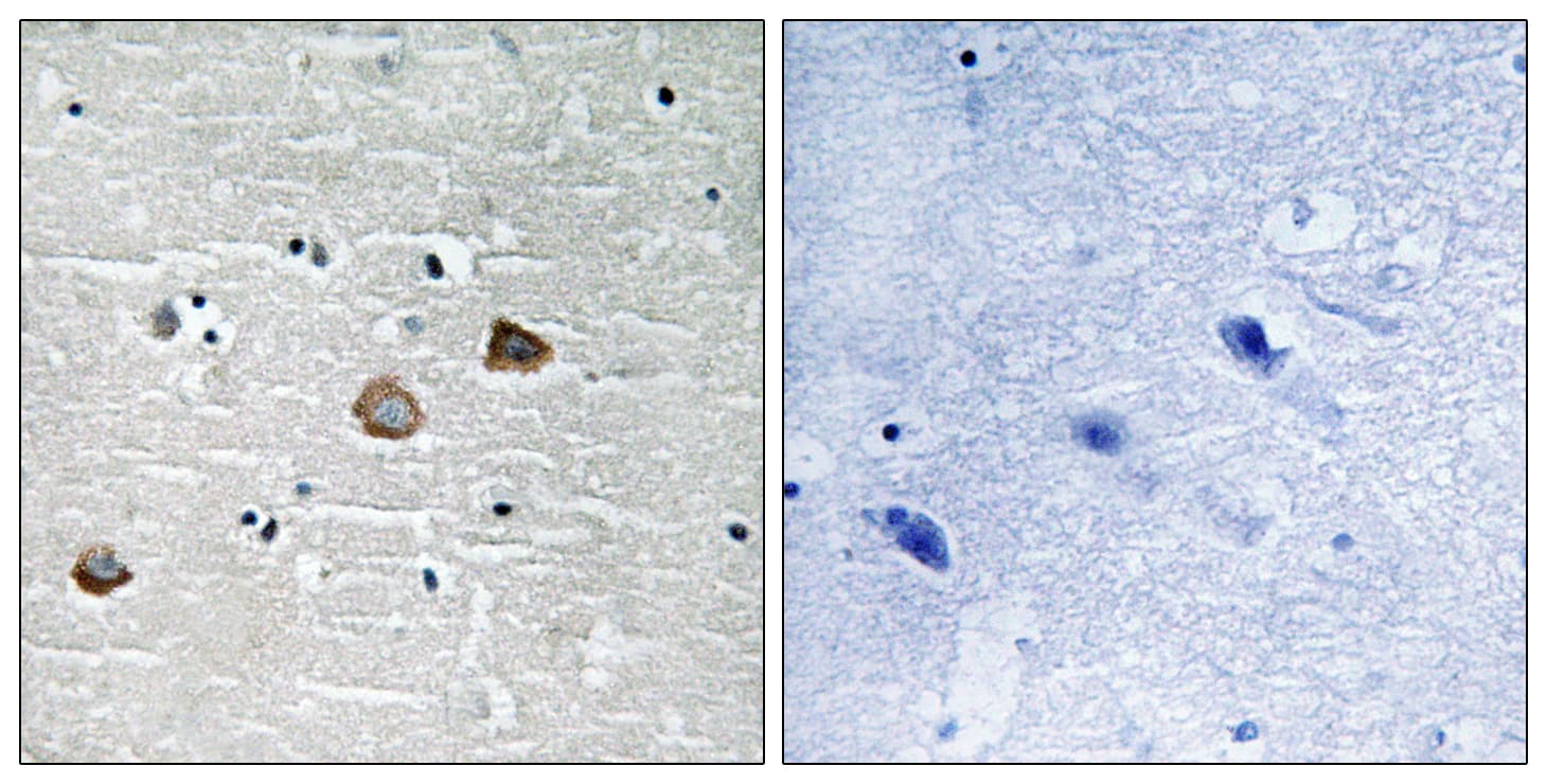 CaMKII Beta+Gamma+Delta Antibody (phospho-Thr287)