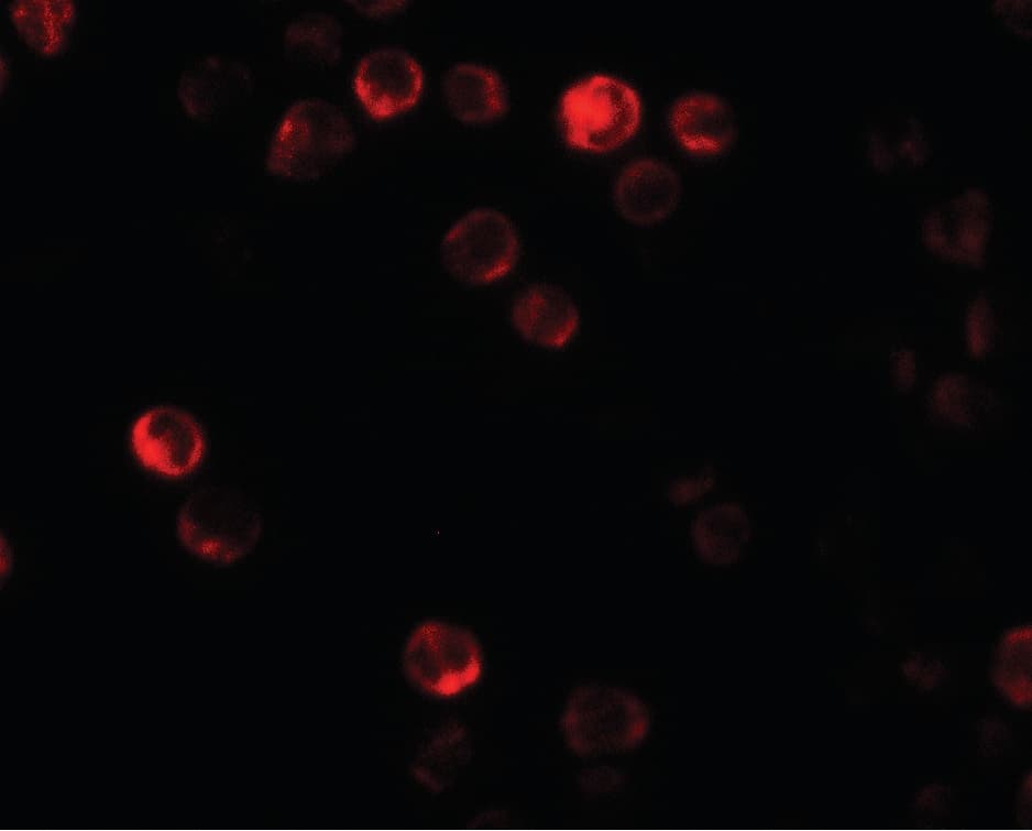IHC-plus™ Polyclonal Rabbit anti-Human ATG2B Antibody (IHC, IF, WB)