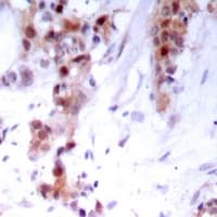 Polyclonal Rabbit anti-Human NFKB2 Antibody (C-Terminus, IHC, WB)