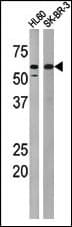PKMYT1 Antibody (phospho-Thr495)