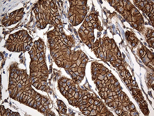 SPTAN1 / Alpha Fodrin Antibody (aa1-147, clone OTI9C10)