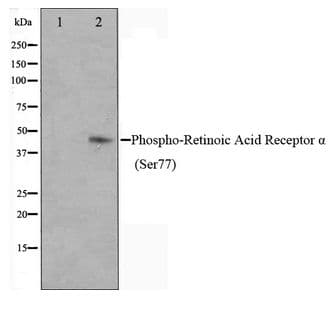 Polyclonal Rabbit anti-Human RARA / RAR Alpha Antibody (phospho-Ser77, IHC, WB)