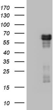 RIPK3 / RIP3 Antibody (aa233-518, clone OTI1D9)