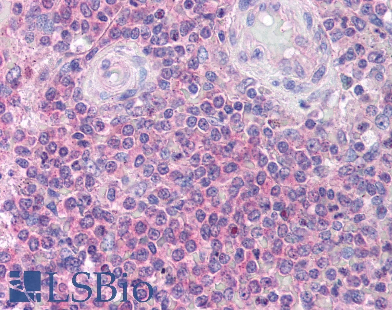 IHC-plus™ IRAK4 / IRAK-4 Antibody