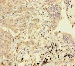 GBP6 Antibody