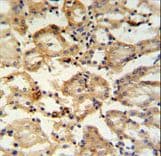 RHBG Antibody (aa423-450)