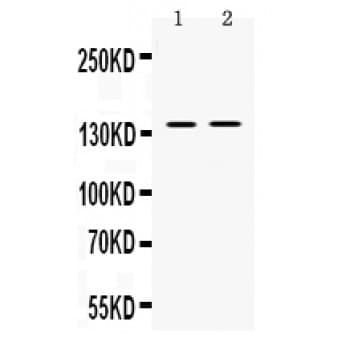 TRPM4 Antibody (aa1079-1214)