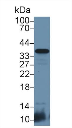 CD8B / CD8 Beta Antibody (aa22-175)