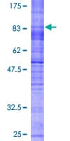 Human SLC7A7 Protein (Recombinant GST)
