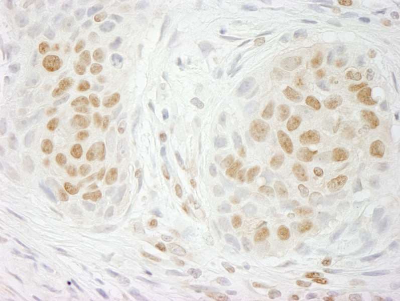 Polyclonal Rabbit anti-Human GIT2 Antibody (aa500-550, IHC)