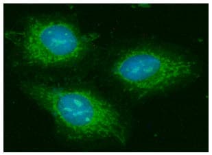 GOT2 Antibody (clone AT8B11)