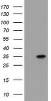 ACY3 Antibody (clone OTI2D5, Carrier-free)