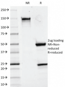 CD20 Antibody (clone 93-1B3)