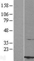 RBX1 / ROC1 Protein (Over-Expression Lysate Myc-DDK (Flag))