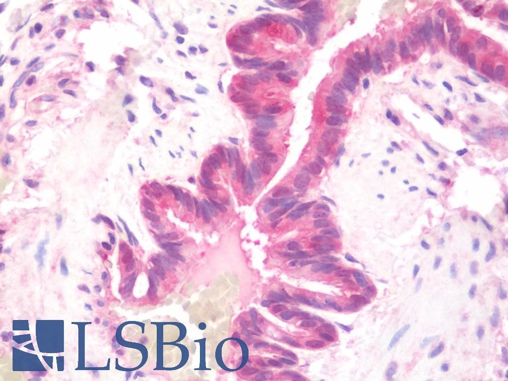 IHC-plus™ DNAJB6 Antibody (aa1-116)
