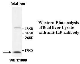 Polyclonal Rabbit anti-Human IL9 Antibody (aa26-144, IHC, WB)