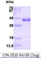 Human HMT / HNMT Protein (Recombinant His)