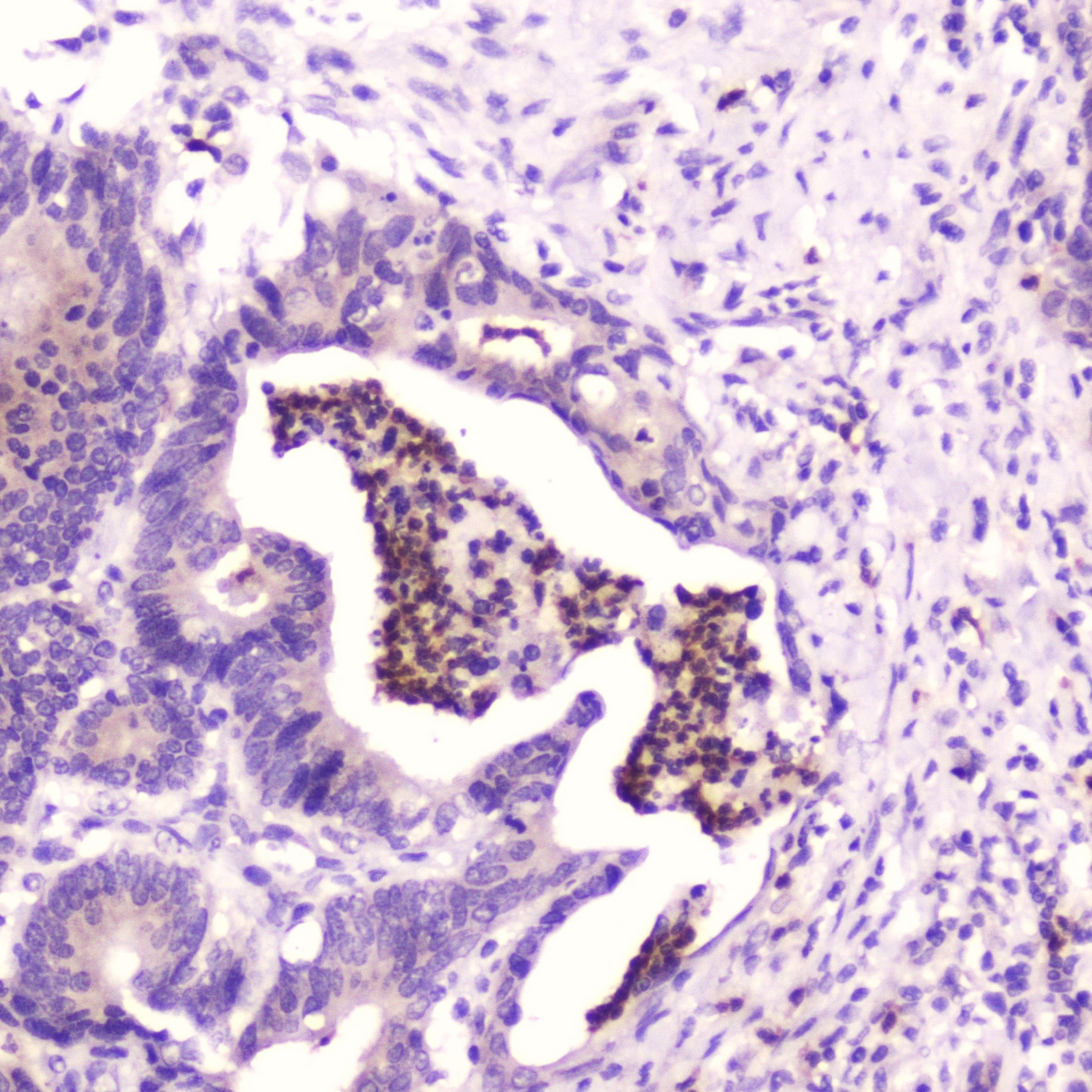 SPARCL1 / Hevin Antibody