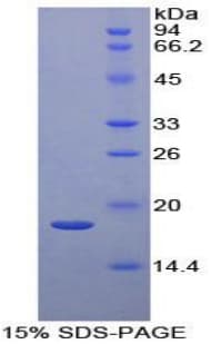 Human LAMTOR3 / MP1 Protein (Recombinant His-T7)