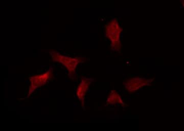 Polyclonal Rabbit anti-Human PTPN11 / SHP-2 / NS1 Antibody (IHC, IF, WB)