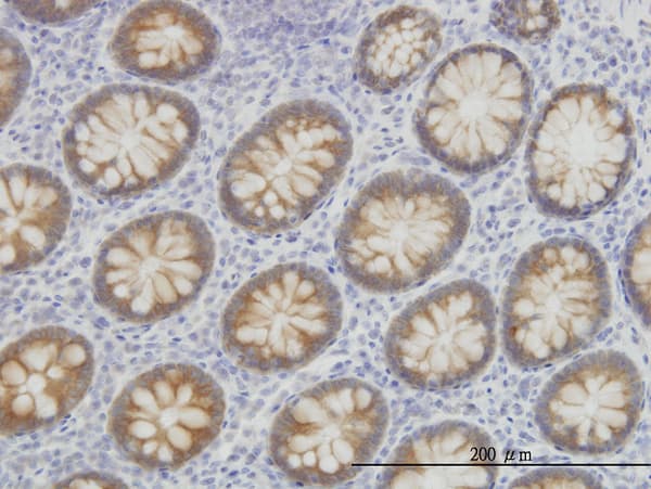 ACS5 / ACSL5 Antibody (clone 5H8)
