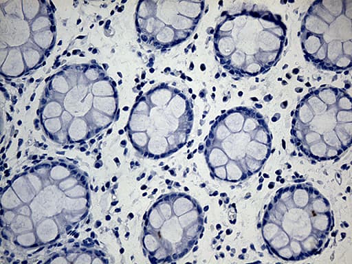 Monoclonal Mouse anti-Human ACAA1 Antibody (clone OTI4F1, IHC, WB)