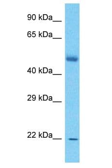 DMRT1 Antibody (aa92-141)