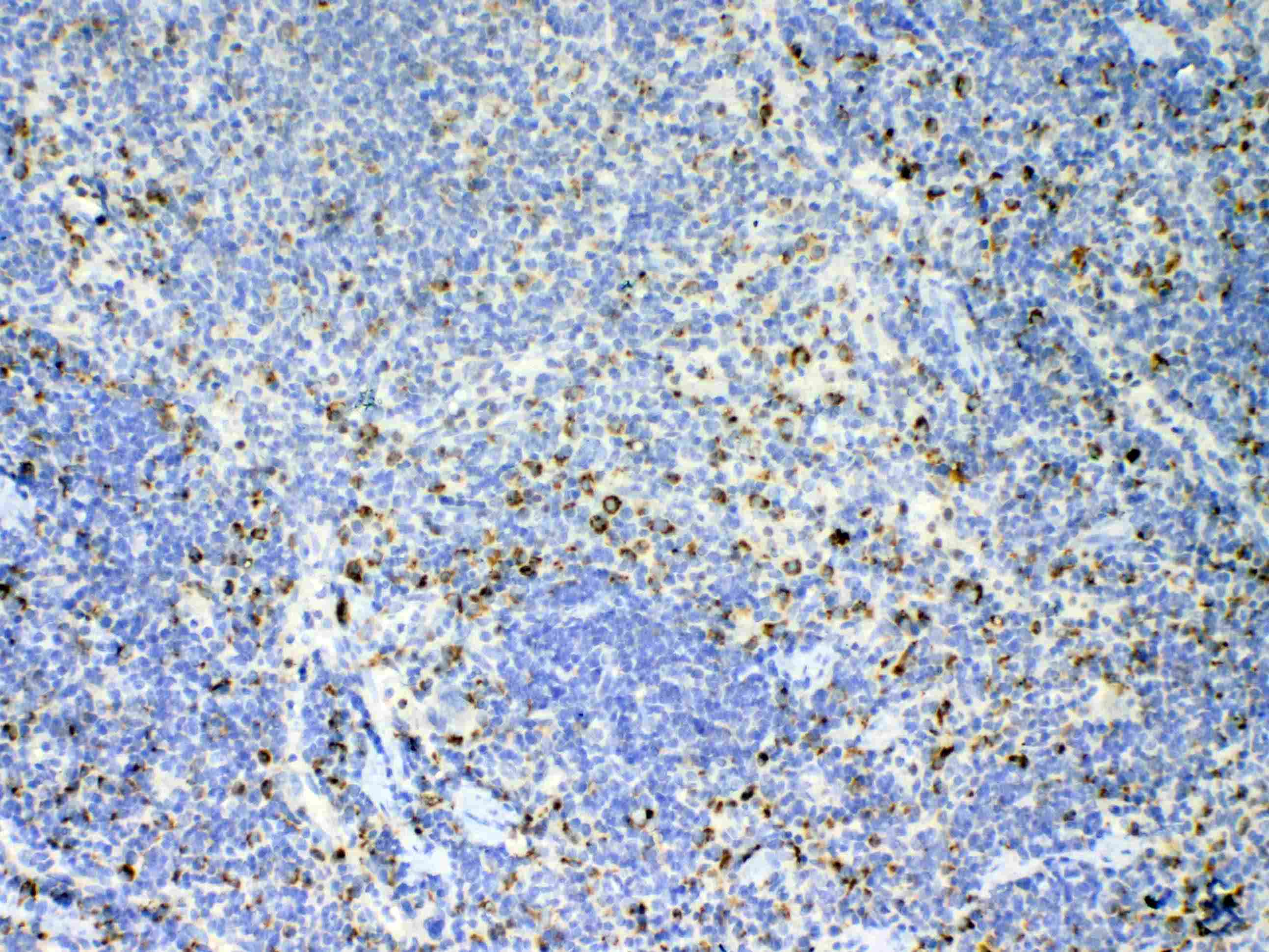 IL17A Antibody