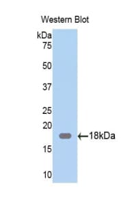Zyxin Antibody (aa377-523, Cy3)