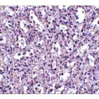 TBC1D10C / CARABIN Antibody