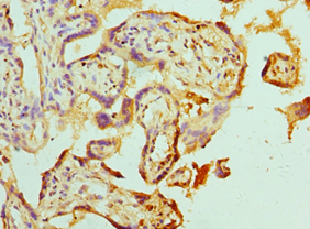 Polyclonal Rabbit anti-Human ABAT Antibody (aa29-300, IHC, WB)