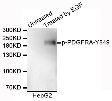 PDGFRA / PDGFR Alpha Antibody (phospho-Tyr849)