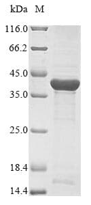 Neisseria meningitidis porB Protein (Recombinant 6His, N-terminus)