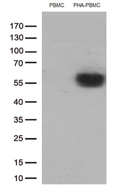 Monoclonal Mouse anti-Human PDCD1 / CD279 / PD-1 Antibody (clone UMAB199, IHC, IF, WB)