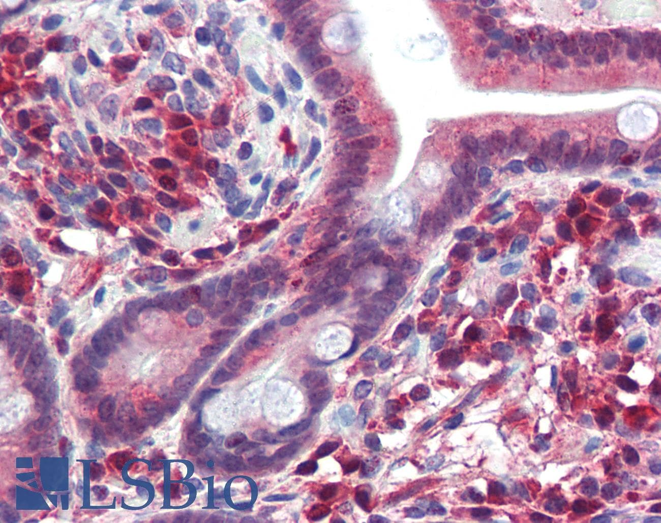 TRIM35 Antibody (aa359-408)