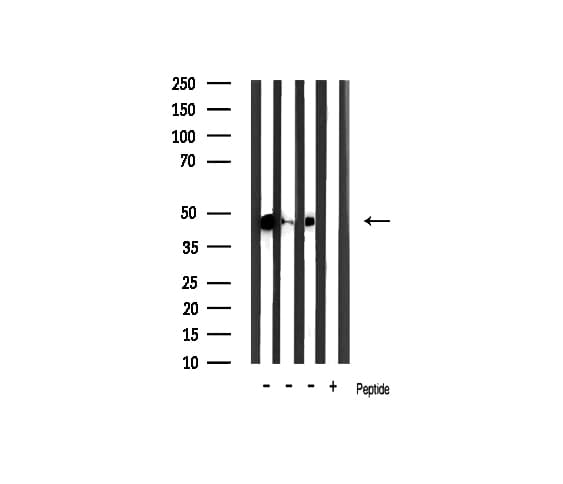 GSK3B / GSK3 Beta Antibody (phospho-Ser9)