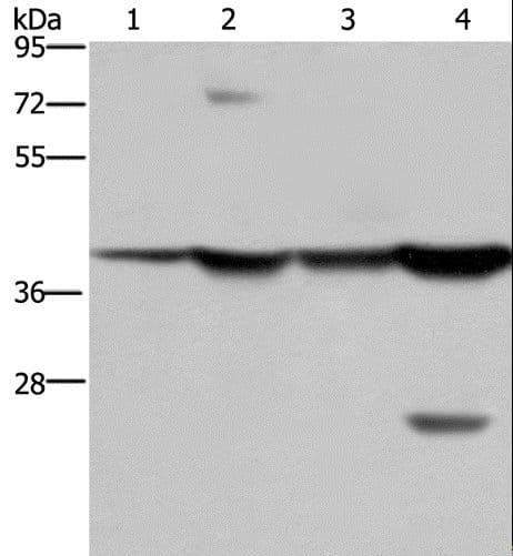 FBP1 Antibody