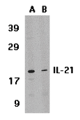 IHC-plus™ Polyclonal Rabbit anti-Human IL21 Antibody (IHC, WB)