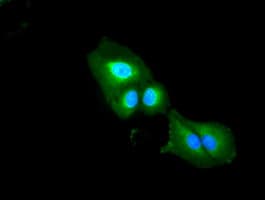 Monoclonal Mouse anti-Human DFFA / ICAD / DFF45 Antibody (clone OTI5C4, IF, WB)