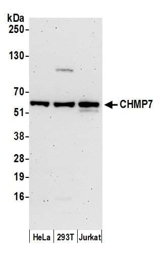 Polyclonal Rabbit anti-Human CHMP7 Antibody (aa300-350, WB)