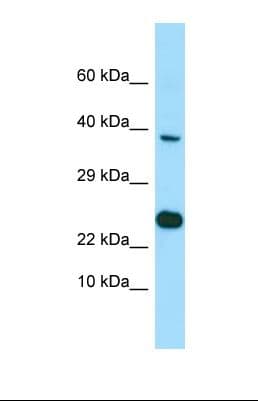 BMP8B Antibody (aa31-80)