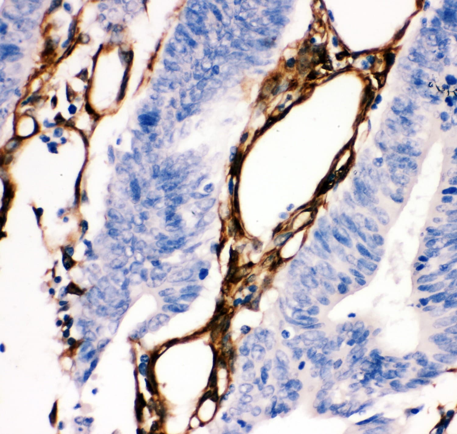 HSPB1 / HSP27 Antibody (aa1-205)